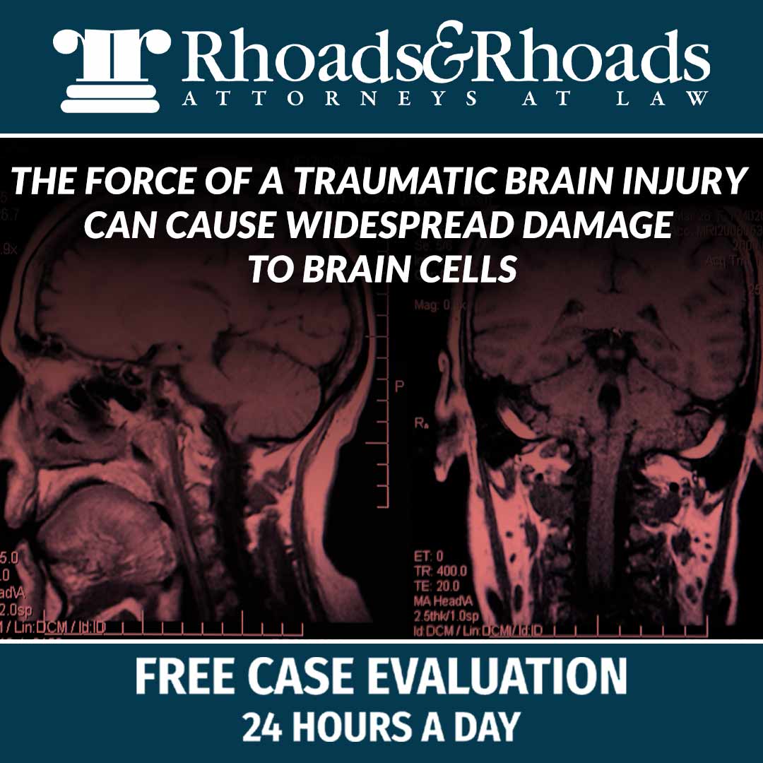 Owensboro Brain Injury Lawyers | Kentucky TBI Lawyers